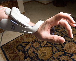 7.24.2008
Dr. Richard Esper and Bioness H200, a hand orthotic, which electrically stimulates fingers to open and close a separate box attached by a cord controls the time of opening and closing intervals. Esper has had the device, which insurance would not cover, for 4 months and he uses it 2-3 hours a day 4-5 days a week in an effort to reestablish pathways between the brain and the hand.