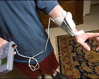 7.24.2008
Dr. Richard Esper and Bioness H200, a hand orthotic, which electrically stimulates fingers to open and close a separate box attached by a cord controls the time of opening and closing intervals. Esper has had the device, which insurance would not cover, for 4 months and he uses it 2-3 hours a day 4-5 days a week in an effort to reestablish pathways between the brain and the hand.