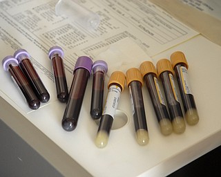 A nurse at an HIV/AIDS clinic takes weekly blood samples from Michael Bushara, a gay, white male in Youngstown. Medical check-ups and the pill regiment divide the day, Michael said.