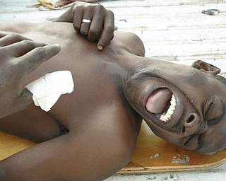 An earthquake victim reacts as he is moved from a flatbed truck on to a plane to be transported for medical treatment in the Dominican Republic,Wednesday, Jan. 13, 2010. A team of doctors from University/Jackson Memorial Ryder Trauma Center arrived in Haiti to aid in medical care for victims of the worst earthquake to hit the island in 200 years.
