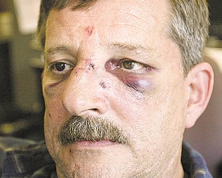 Richard Rounds, a vending-machine repairman, bears the wounds he suffered while being beaten in an apartment complex in Warren.
