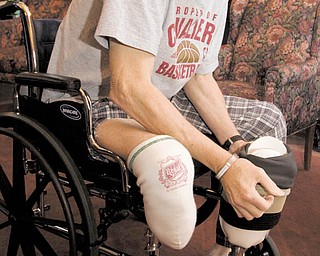 Joseph Zajac shows his prosthesis at Greenbriar Healthcare Center.