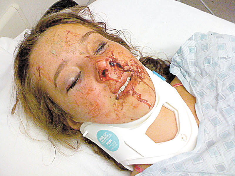 Elaine's aunt found her in a large puddle of blood unconscious and rushed her to a Warren hospital. She received reconstructive facial surgery the next day.