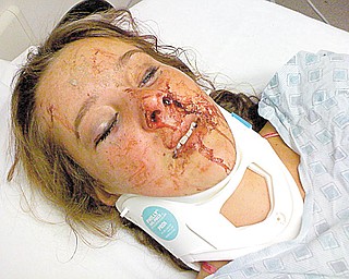 Elaine's aunt found her in a large puddle of blood unconscious and rushed her to a Warren hospital. She received reconstructive facial surgery the next day.