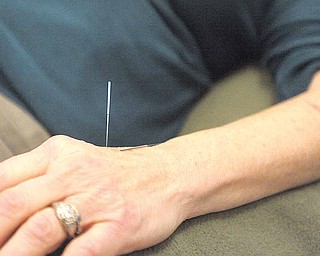 Fred Wolfson, owner of "Acupuncture For All" treats several patients at a time in a peaceful, communal room, which keeps the costs down to what a normal acupuncture procedure costs. Here, Wolfson inserts needles into Lynn Hunovice, who gets treatment on her feet, arthritic joints and for uses acupuncture for balance and energy, December 14, 2010, in Baltimore, Maryland.
