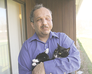 Austintown resident Ed Port, 41, poses with his cat, Spike, on the balcony of his apartment. Earlier this month, Port, who suffers from neurofibromatosis, underwent a third surgery to remove large tumors that covered much of his face.