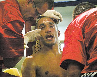 Trainers attend to boxer Jake Giuriceo between rounds of his win against James Hope. The Campbell boxer’s career is on hold after undergoing surgery to repair a detached retina in right eye, which he injured during his Dec. 1 bout with Kenyan boxer Peter Olouch.
