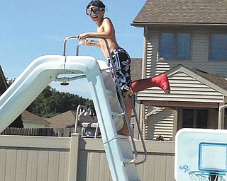 Because of new waterproof casts, summer wasn't ruined for Jacob Buttar of Niles!