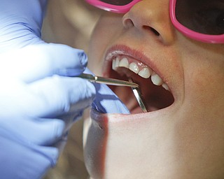        ROBERT K. YOSAY  | THE VINDICATOR..Checking the students teeth  before they clean them as  Dr. Sergio Nadler,, and dental hygenist and Choffin student working on kids from Head Start programs in Trumbull County and to students from Summit Academy during Corydon Palmer Society Give Kids a Smile program.  Dentists and internists from St Elizabeths and Valley Care