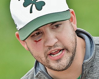 Jeff Lange | The Vindicator  WED, MAR 30, 2016 - Ursuline head coach Matt Weymer sports a shiner after being hit by a ball during pregame warmups at Bob Cene Park in Struthers Wednesday afternoon.