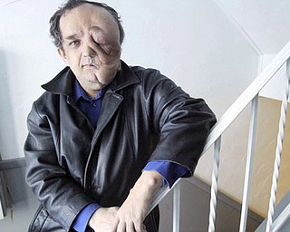 Living with Neurofibromatosis